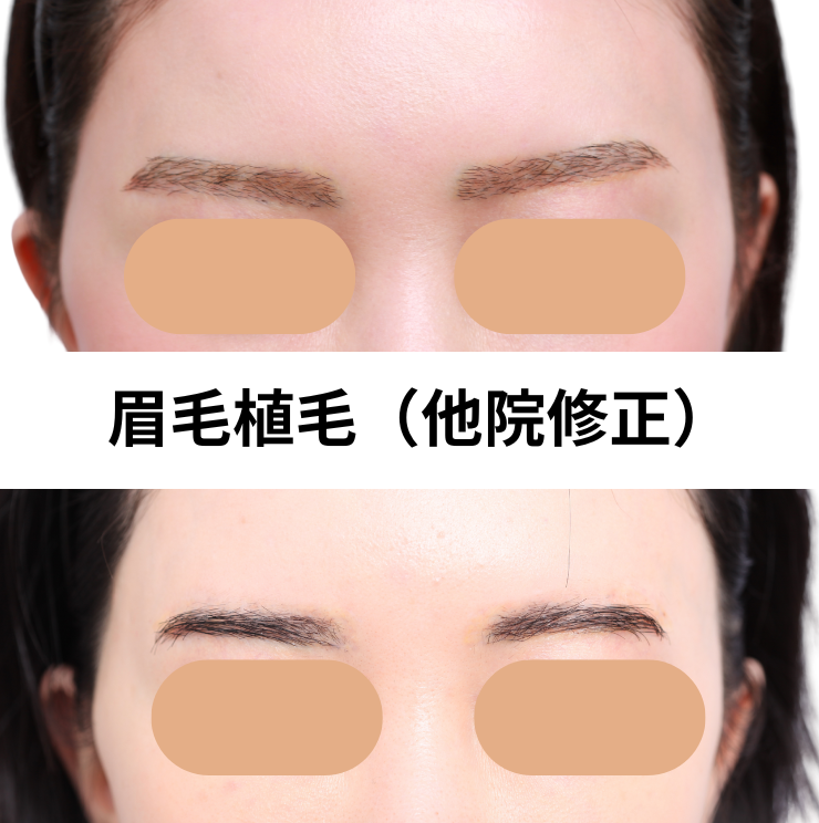 他院修正眉毛